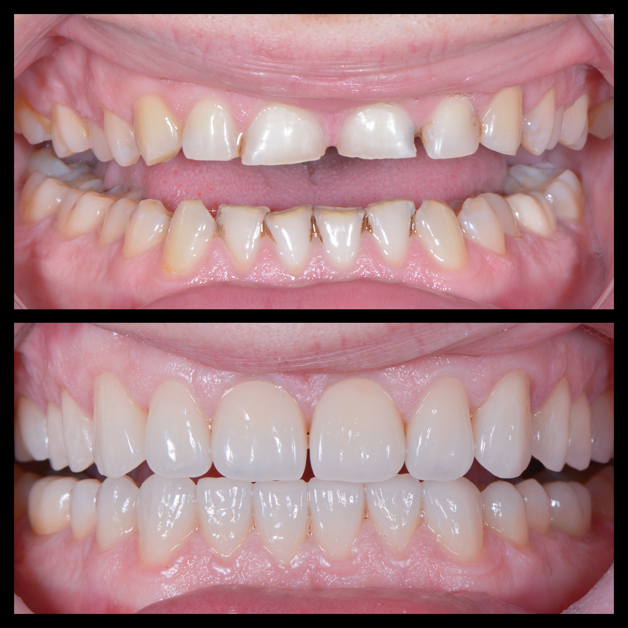 Refacere integritate structurală și a aspectului natural